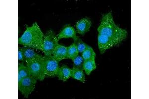 IF analysis of ALDH2 using anti-ALDH2 antibody (ABIN7603107). (ALDH2 anticorps  (N-Term))