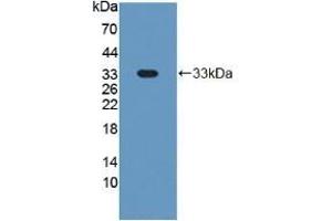 Detection of Recombinant GP1Ba, Mouse using Polyclonal Antibody to Cluster Of Differentiation 42b (CD42b) (CD42b anticorps  (AA 17-282))