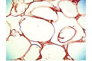 Human visceral white fat tissue was stained by Rabbit Anti-Vaspin (63-104) (Human) Serum