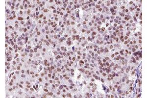 ABIN6268826 at 1/100 staining human liver tissue sections by IHC-P. (ZEB2 anticorps  (N-Term))