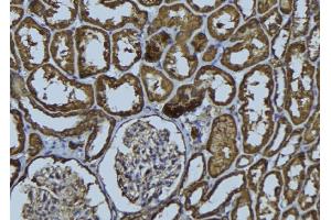 ABIN6279275 at 1/100 staining Rat kidney tissue by IHC-P.