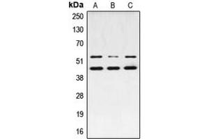 Western blot analysis of JNK1/2/3 (pT183) expression in MCF7 PMA-treated (A), NIH3T3 UV-treated (B), PC12 PMA-treated (C) whole cell lysates. (JNK anticorps  (pSer183))