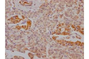 IHC image of ABIN7127485 diluted at 1:100 and staining in paraffin-embedded human pancreatic tissue performed on a Leica BondTM system. (Recombinant FBP1 anticorps)