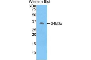 Western blot analysis of the recombinant protein. (MT1E anticorps  (AA 1-61))