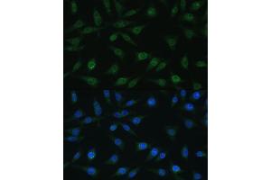 Immunofluorescence analysis of L929 cells using NUP98 antibody (ABIN1681142, ABIN3015191, ABIN3015192, ABIN5663696 and ABIN6213876) at dilution of 1:100. (NUP98 anticorps  (AA 621-920))