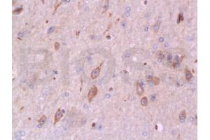 Formalin-fixed and paraffin embedded rabbit brain tissue labeled with Anti-Bax Polyclonal Antibody, Unconjugated (ABIN725390) at 1:200 followed by conjugation to the secondary antibody and DAB staining