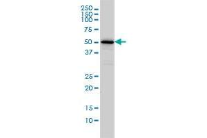 CAMKK1 monoclonal antibody (M01A), clone 1F6 Western Blot analysis of CAMKK1 expression in Jurkat . (CAMKK1 anticorps  (AA 1-520))