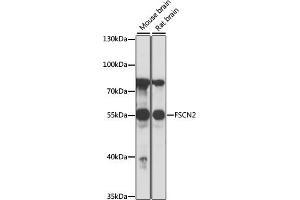 Western blot analysis of extracts of various cell lines, using FSCN2 antibody (ABIN7267143) at 1:1000 dilution. (Fascin 2 anticorps  (AA 1-310))
