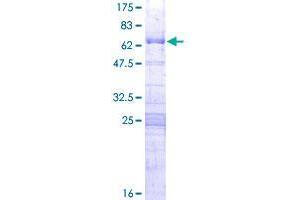 Image no. 1 for Ribosome Production Factor 2 Homolog (RPF2) (AA 1-306) protein (GST tag) (ABIN1347000)