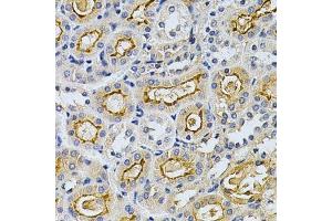 Immunohistochemistry of paraffin-embedded mouse kidney using ADRBK1 Antibody.