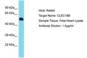 Image no. 1 for anti-C-Type Lectin Domain Family 18, Member C (CLEC18C) (AA 303-352) antibody (ABIN6750826) (CLEC18C anticorps  (AA 303-352))