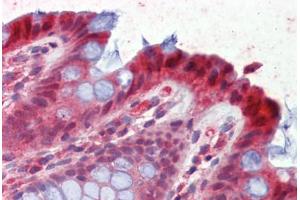 Human Colon (formalin-fixed, paraffin-embedded) stained with HPGD antibody ABIN462285 followed by biotinylated anti-goat IgG secondary antibody ABIN481715, alkaline phosphatase-streptavidin and chromogen. (HPGD anticorps  (AA 255-266))
