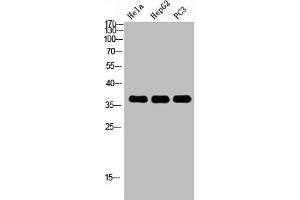 Western Blot analysis of HELA HEPG2 PC-3 using p38 Polyclonal Antibody.
