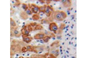 IHC-P analysis of Liver tissue, with DAB staining. (Apolipoprotein M anticorps  (AA 20-190))