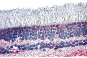 Anti-NR2E3 antibody  ABIN1049136 IHC staining of human retina. (NR2E3 anticorps  (N-Term))