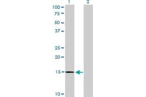 Western Blot analysis of NXT1 expression in transfected 293T cell line by NXT1 monoclonal antibody (M08), clone 4F11. (NXT1 anticorps  (AA 1-140))