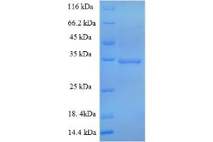 SDS-PAGE (SDS) image for S-Phase Kinase-Associated Protein 1 (SKP1) (AA 2-163) protein (GST tag) (ABIN5710368)