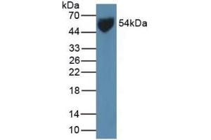 Detection of GLUT1 in Human Serum using Polyclonal Antibody to Glucose Transporter 1 (GLUT1)