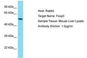 Image no. 1 for anti-Forkhead Box P3 (FOXP3) (AA 23-72) antibody (ABIN6750280) (FOXP3 anticorps  (AA 23-72))