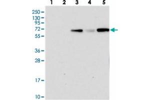 Western blot analysis of Lane 1: RT-4, Lane 2: U-251 MG, Lane 3: Human Plasma, Lane 4: Liver, Lane 5: Tonsil with PLEKHG6 polyclonal antibody . (PLEKHG6 anticorps)