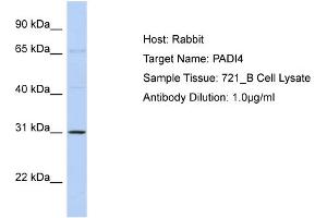 Host: Rabbit Target Name: PADI4 Sample Type: 721_B Cell lysates Antibody Dilution: 1. (PAD4 anticorps  (Middle Region))