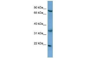 ABCD2 antibody used at 0. (CCL17 anticorps  (N-Term))