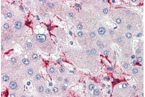 Human Liver (formalin-fixed, paraffin-embedded) stained with TSKS antibody ABIN462256 followed by biotinylated goat anti-rabbit IgG secondary antibody ABIN481713, alkaline phosphatase-streptavidin and chromogen.