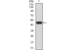 Western blot analysis using DHX58 mAb against human DHX58 (AA: 479-678) recombinant protein. (DHX58 anticorps  (AA 479-678))