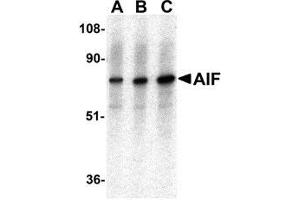Western blot analysis of AIF in K562 with AP30031PU-N AIF antibody at (A) 0. (AIF anticorps  (C-Term))