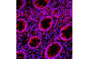 Immunofluorescence of paraffin embedded human colon using NAIF1 (ABIN7074867) at dilution of 1:650 (400x lens)