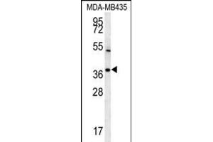 TNIP3 antibody  (N-Term)