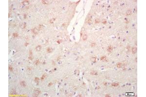 Formalin-fixed and paraffin embedded rat brain labeled with Rabbit Anti Phospho-PPIG (Ser376) Polyclonal Antibody, Unconjugated (ABIN746678) at 1:200 followed by conjugation to the secondary antibody and DAB staining (PPIG anticorps  (pSer376))