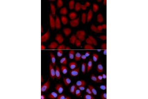Immunofluorescence analysis of U2OS cells using TAP2 antibody (ABIN5970782). (TAP2 anticorps)