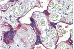 Human Placenta: Formalin-Fixed, Paraffin-Embedded (FFPE)