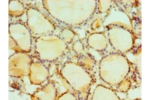 Immunohistochemistry of paraffin-embedded human thyroid tissue using ABIN7149566 at dilution of 1:100 (DIDO1 anticorps  (AA 1-300))
