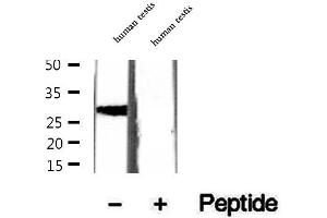 Western blot analysis of extracts of human testis tissue, using CRISP2 antibody. (CRISP2 anticorps  (Internal Region))