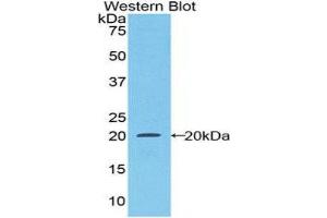 Western Blotting (WB) image for anti-Colony Stimulating Factor 1 Receptor (CSF1R) (AA 734-900) antibody (ABIN1174698) (CSF1R anticorps  (AA 734-900))