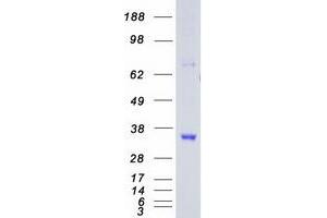 Validation with Western Blot