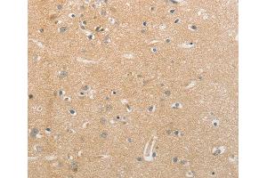 Immunohistochemistry (IHC) image for anti-Neurofascin (NFASC) (AA 830-1100) antibody (ABIN3017267)
