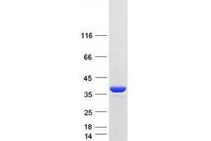 Validation with Western Blot