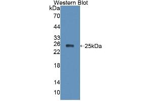 Figure. (XPO5 anticorps  (AA 2-180))