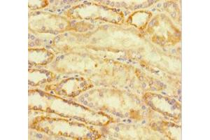 Immunohistochemistry of paraffin-embedded human kidney tissue using ABIN7172767 at dilution of 1:100 (ATRX anticorps  (AA 2161-2443))
