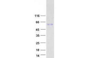 Validation with Western Blot