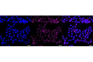 Immunocytochemical staining of HAP-1 cells with GST3 / GSTP1 antibody (ABIN7798758), 1:1,000). (Recombinant GSTP1 anticorps)