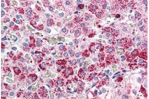 Adrenal, Human: Formalin-Fixed, Paraffin-Embedded (FFPE) (CCKAR anticorps  (Internal Region))
