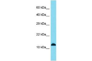 Host: Rabbit Target Name: SPANXB1 Sample Type: A549 Whole Cell lysates Antibody Dilution: 1. (SPANXB1 anticorps  (Middle Region))
