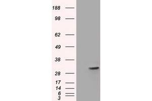 Western Blotting (WB) image for anti-Four and A Half LIM Domains 1 (FHL1) antibody (ABIN1500976)