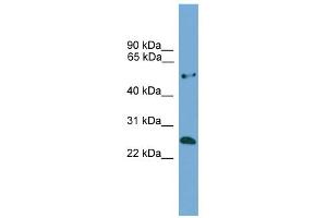 WB Suggested Anti-ETHE1 Antibody Titration: 0.