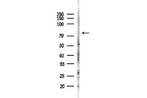 Western blot analysis of lysates from PC12 cells(LPS 4h treatment), using CHM Antibody at 1/1000 dilution.