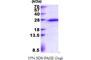 Image no. 1 for Ribosomal Protein S5 (RPS5) (AA 1-204) protein (His tag) (ABIN1098468)